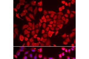 Immunofluorescence analysis of U2OS cells using TNP2 Polyclonal Antibody (TNP2 anticorps)