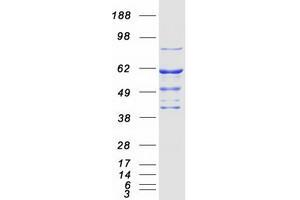 Validation with Western Blot