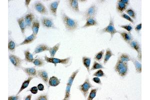 Anti- PARK7 Picoband antibody,ICC ICC: A549 Cell