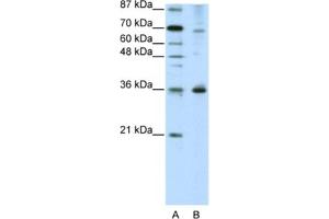 Western Blotting (WB) image for anti-Forkhead Box Q1 (FOXQ1) antibody (ABIN2461965)