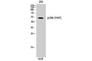 Western Blotting (WB) image for anti-PTK6 Protein tyrosine Kinase 6 (PTK6) (pTyr447) antibody (ABIN3173172) (PTK6 anticorps  (pTyr447))