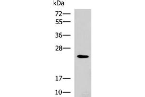 Western blot analysis of NIH/3T3 cell lysate using RAB38 Polyclonal Antibody at dilution of 1:900 (RAB38 anticorps)