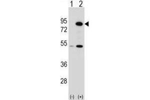 Western blot analysis of THOC1 (arrow) using rabbit polyclonal THOC1 Antibody (C-term) . (THOC1 anticorps  (C-Term))