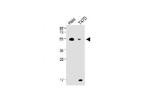 All lanes : Anti-B4GalT1 Antibody (C-term) at 1:1000 dilution Lane 1: Hela, whole cell lysate Lane 2: T47D whole cell lysate ysates/proteins at 20 μg per lane.