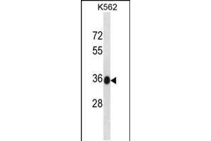 Western blot analysis in K562 cell line lysates (35ug/lane). (MMACHC anticorps  (C-Term))