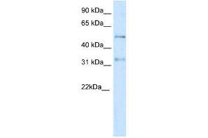 WB Suggested Anti-KCNAB2  Antibody Titration: 0. (KCNAB2 anticorps  (Middle Region))