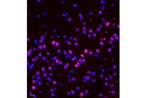 Immunofluorescence of paraffin embedded rat brain using CDY1 (ABIN7073493) at dilution of 1:400 (400x lens)