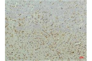 Immunohistochemical analysis of paraffin-embedded Mouse Brain Tissue using PPAR Delta Mouse mAb diluted at 1:200. (PPARD anticorps)