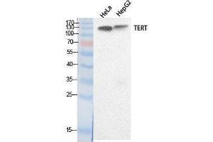Western Blotting (WB) image for anti-Telomerase Reverse Transcriptase (TERT) (Internal Region) antibody (ABIN3181058) (TERT anticorps  (Internal Region))