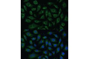 Immunofluorescence analysis of L929 cells using  Polyclonal Antibody (ABIN7265476) at dilution of 1:100 (40x lens). (ARL1 anticorps  (AA 62-181))