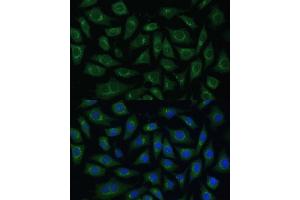 Immunofluorescence analysis of L929 cells using  Polyclonal Antibody (ABIN7265476) at dilution of 1:100 (40x lens). (ARL1 anticorps  (AA 62-181))