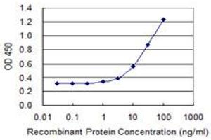 Detection limit for recombinant GST tagged TIMM8B is 0.