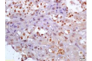 Formalin-fixed and paraffin embedded mouse placenta labeled with Anti-Glutamine PRPP amidotransferase Polyclonal Antibody, Unconjugated (ABIN872980) at 1:200 followed by conjugation to the secondary antibody and DAB staining (PPAT anticorps  (AA 351-430))