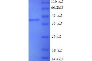 SDS-PAGE (SDS) image for Thrombospondin 1 (THBS1) (AA 19-350), (partial) protein (His tag) (ABIN5713890)