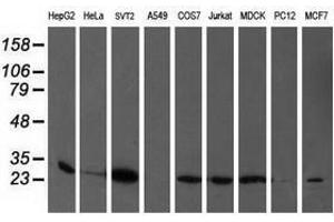 Image no. 2 for anti-phosphoglycerate Mutase 2 (Muscle) (PGAM2) antibody (ABIN1500171)