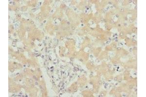 Immunohistochemistry of paraffin-embedded human liver tissue using ABIN7174300 at dilution of 1:100 (USP26 anticorps  (AA 664-913))
