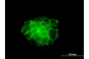 Immunofluorescence of monoclonal antibody to KRT4 on A-431 cell. (KRT4 anticorps  (AA 194-300))