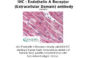 Image no. 1 for anti-Endothelin Receptor Type A (EDNRA) (3rd Extracellular Domain) antibody (ABIN1734023)