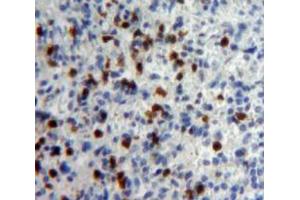IHC-P analysis of Spleen tissue, with DAB staining. (IFNA5 anticorps  (AA 22-189))