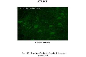 Sample Type :  Rhesus macaque spinal cord  Primary Antibody Dilution :  1:300  Secondary Antibody :  Donkey anti Rabbit 488  Secondary Antibody Dilution :  1:500  Color/Signal Descriptions :  Green: ATP2A1  Gene Name :  ATP2A1  Submitted by :  Timur Mavlyutov, Ph. (ATP2A1/SERCA1 anticorps  (N-Term))