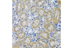 Immunohistochemistry of paraffin-embedded mouse kidney using ACP1 antibody at dilution of 1:100 (x40 lens).