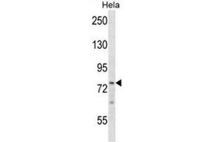 BRF1 Antibody (Center) western blot analysis in Hela cell line lysates (35µg/lane). (BRF1 anticorps  (Middle Region))