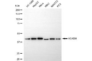 Western blotting analysis using ACADM antibody (ABIN7799351). (Recombinant Medium-Chain Specific Acyl-CoA Dehydrogenase, Mitochondrial (MCAD) anticorps)