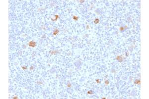 Immunohistochemistry (IHC) image for anti-BCL2-Like 1 (BCL2L1) (AA 1-135) antibody (ABIN6940516) (BCL2L1 anticorps  (AA 1-135))
