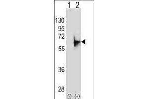 Western blot analysis of NMT2 (arrow) using rabbit polyclonal NMT2 Antibody (E31) (ABIN389095 and ABIN2839287). (NMT2 anticorps  (N-Term))