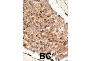 Immunohistochemistry (IHC) image for anti-Bone Morphogenetic Protein 10 (BMP10) antibody (ABIN2999217) (BMP10 anticorps)