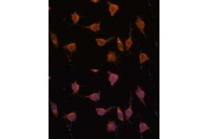 Immunofluorescence analysis of L929 cells using V antibody  at dilution of 1:100.