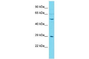 Host:  Rabbit  Target Name:  Camk4  Sample Type:  Mouse Testis lysates  Antibody Dilution:  1. (CAMK4 anticorps  (C-Term))