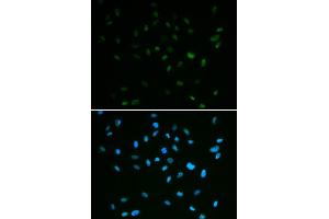 Immunofluorescence analysis of A549 cell using MSH6 antibody. (MSH6 anticorps)