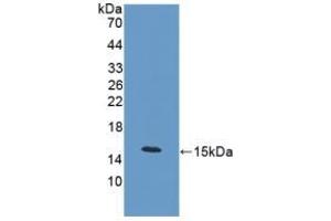 Detection of Recombinant PCT, Mouse using Polyclonal Antibody to Procalcitonin (PCT) (Procalcitonin anticorps  (AA 26-136))
