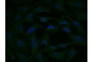 HT-55 cells were stained with bs-0223R Rabbit Anti-MEK2 Polyclonal Antibody at 1:250.