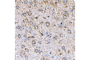 IHC analysis of RAB7/RAB7A using anti-RAB7/RAB7A antibody (ABIN7600597). (RAB7A anticorps  (AA 21-177))