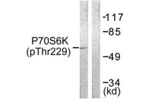 Western blot analysis of extracts from Jurkat cells, using p70 S6 Kinase (Phospho-Thr229) Antibody.