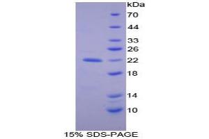 SDS-PAGE analysis of Human Apolipoprotein B Protein.
