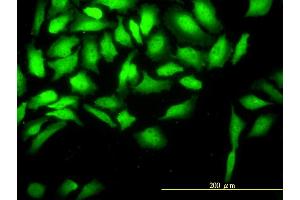 Immunofluorescence of monoclonal antibody to CKS2 on HeLa cell.