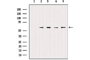 Western blot analysis of extracts from various samples, using SOX9 Antibody. (SOX9 anticorps)