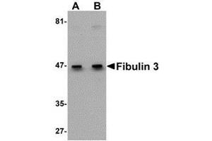 Western blot analysis of Fibulin 3 in HeLa cell lysate with AP30337PU-N Fibulin 3 antibody at (A) 0. (FBLN3 anticorps  (C-Term))