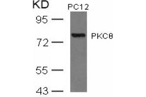 Image no. 3 for anti-Protein Kinase C, theta (PRKCQ) (AA 674-678) antibody (ABIN197566) (PKC theta anticorps  (AA 674-678))