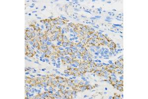 Immunohistochemistry of paraffin-embedded Rat ovary using BOL Rabbit pAb (ABIN7265891) at dilution of 1:50 (40x lens).