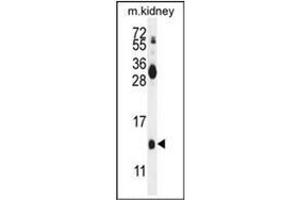 Western blot analysis of Midkine Antibody (C-term) in mouse kidney tissue lysates (35ug/lane). (Midkine anticorps  (C-Term))