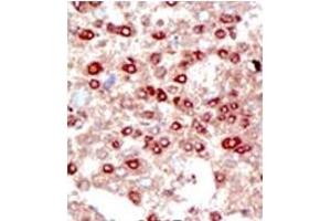 Image no. 3 for anti-Small Ubiquitin Related Modifier 3 (SUMO3) (C-Term) antibody (ABIN356741)