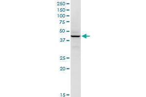 RFC5 monoclonal antibody (M01), clone 1B1.