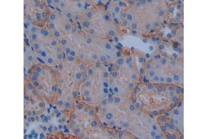 Used in DAB staining on fromalin fixed paraffin- embedded kidney tissue (ABCB10 anticorps  (AA 457-715))