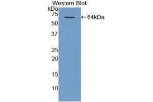 Detection of Recombinant MBP, Human using Polyclonal Antibody to Major Basic Protein (MBP) (Major Basic Protein anticorps  (AA 105-222))