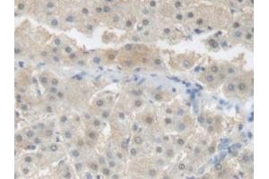 Detection of CRP in Human Liver Tissue using Polyclonal Antibody to C Reactive Protein (CRP) (CRP anticorps  (AA 17-224))