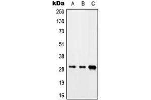 Western blot analysis of CIP29 expression in Jurkat (A), mouse heart (B), rat liver (C) whole cell lysates. (SARNP anticorps  (C-Term))